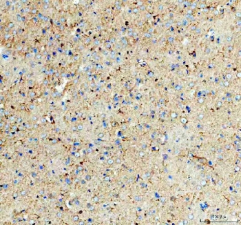 IHC staining of FFPE rat brain tissue with Glycogen synthase kinase-3 beta antibody. HIER: boil tissue sections in pH8 EDTA for 20 min and allow to cool before testing.
