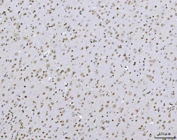 IHC staining of FFPE rat brain tissue with TCF-8 antibody. HIER: boil tissue sections in pH8 EDTA for 20 min and allow to cool before testing.
