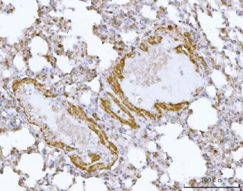 HBEGF Antibody Mouse Lung IHC. Immunohistochemistry analysis of FFPE mouse lung tissue stained with HBEGF antibody detecting Heparin-binding EGF-like growth factor (DT-R). Epithelial cells lining airway and alveolar structures show membranous and cytoplasmic staining, consistent with localization of HBEGF as a cell surface receptor capable of mediating diphtheria toxin binding and receptor-mediated internalization, as well as EGFR ligand signaling. Surrounding stromal regions show comparatively lower signal. Hematoxylin counterstain highlights nuclei in blue. HIER: boil tissue sections in pH 8 EDTA for 20 min and allow to cool before testing.