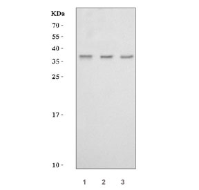 Western blot testing of human 1) RT4, 2) MCF7 and 3) T-47D cell lysate with MSX2 antibody. Expected molecular weight 29-37 kDa.