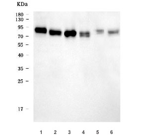 Western blot testing of 1) rat pancreas, 2) rat kidney, 3) mouse pancreas, 4) mouse kidney, 5) mouse testis and 6) mouse NIH 3T3 cell lysate with Slc3a2 antibody. Expected molecular weight: 75-120 kDa depending on glycosylation level.