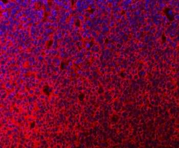 Immunofluorescent staining of FFPE human tonsil tissue with C-1-tetrahydrofolate synthase antibody (red) and DAPI nuclear stain (blue). HIER: steam section in pH8 EDTA buffer for 20 min.