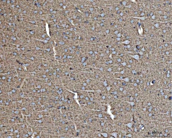 IHC staining of FFPE rat brain tissue with EAAT1 antibody. HIER: boil tissue sections in pH8 EDTA for 20 min and allow to cool before testing.