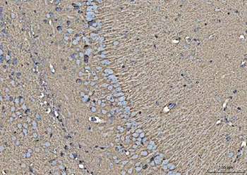 IHC staining of FFPE mouse brain tissue with EAAT1 antibody. HIER: boil tissue sections in pH8 EDTA for 20 min and allow to cool before testing.