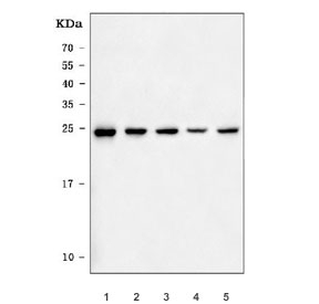 Western blot testing of 1) human Jurkat, 2) human HeLa, 3) human HepG2, 4) human K562 and 5) mouse liver tissue lysate with BAG2 antibody. Predicted molecular weight ~22 kDa.