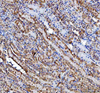 IHC staining of FFPE mouse kidney tissue with Inosine-5'-monophosphate dehydrogenase 2 antibody, HRP-secondary and DAB substrate. HIER: boil tissue sections in pH8 EDTA for 20 min and allow to cool before testing.