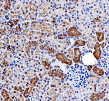 IHC staining of FFPE rat kidney tissue with Inosine-5'-monophosphate dehydrogenase 2 antibody, HRP-secondary and DAB substrate. HIER: boil tissue sections in pH8 EDTA for 20 min and allow to cool before testing.