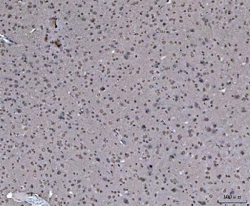 IHC staining of FFPE rat brain tissue with hnRNP U antibody. HIER: boil tissue sections in pH8 EDTA for 20 min and allow to cool before testing.