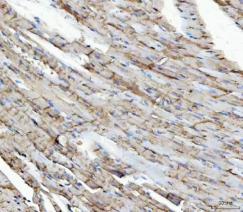 IHC staining of FFPE mouse heart tissue with NDUFS5 antibody. HIER: boil tissue sections in pH8 EDTA for 20 min and allow to cool before testing.