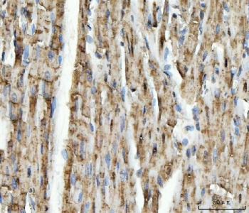 IHC staining of FFPE rat heart tissue with NDUFS5 antibody. HIER: boil tissue sections in pH8 EDTA for 20 min and allow to cool before testing.