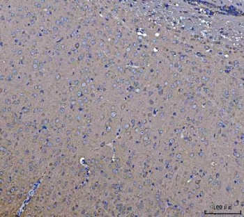 IHC staining of FFPE mouse brain tissue with STK24 antibody. HIER: boil tissue sections in pH8 EDTA for 20 min and allow to cool before testing.