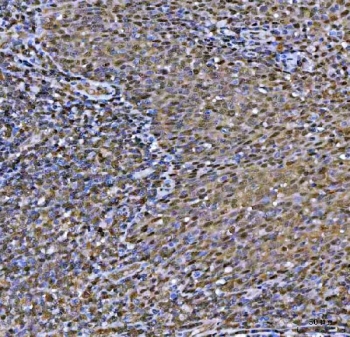 IHC staining of FFPE human tonsil tissue with MAT2A antibody. HIER: boil tissue sections in pH8 EDTA for 20 min and allow to cool before testing.