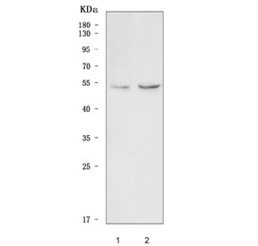 Western blot testing of human 1) K562 and 2) PC-3 cell lysate with Vaccinia-related kinase 2 antibody. Predicted molecular weight: 44-58 kDa (multiple isoforms).