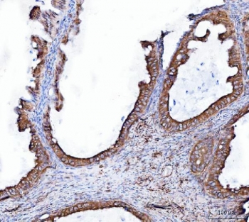 IHC staining of FFPE human ovary tissue with HO-2 antibody. HIER: boil tissue sections in pH8 EDTA for 20 min and allow to cool before testing.