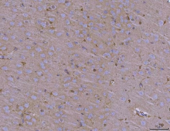 IHC staining of FFPE mouse brain tissue with ADAM22 antibody. HIER: boil tissue sections in pH8 EDTA for 20 min and allow to cool before testing.