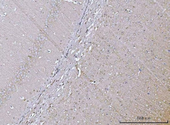 IHC staining of FFPE mouse brain tissue with VPS53 antibody. HIER: boil tissue sections in pH8 EDTA for 20 min and allow to cool before testing.