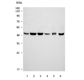 Western blot testing of 1) human HL60, 2) human ThP-1, 3) human MOLT4, 4) human U-937, 5) rat brain and 6) mouse brain tissue lysate with VPS36 antibody. Predicted molecular weight: 37-44 kDa (multiple isoforms).