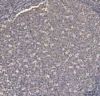 IHC staining of FFPE human tonsil tissue with HOXC4 antibody. HIER: boil tissue sections in pH8 EDTA for 20 min and allow to cool before testing.