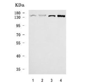 Western blot testing of human 1) HaCaT, 2) A431, 3) U-251 and 4) SiHa cell lysate with Zinc finger MYM-type protein 1 antibody. Predicted molecular weight ~129 kDa.