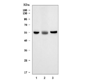 Western blot testing of 1) rat liver, 2) rat RH35 and 3) mouse liver tissue lysate with Glucuronosyltransferase 1A1 antibody. Predicted molecular weight ~59 kDa.