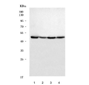 Western blot testing of human 1) HepG2, 2) A549, 3) Jurkat and 4) HeLa cell lysate with Delta-5 desaturase antibody. Predicted molecular weight: ~52 kDa.