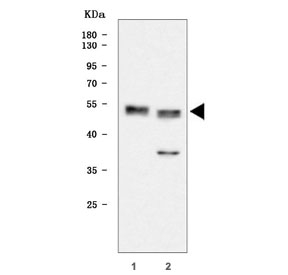 Western blot testing of human 1) T-47D and 2) HeLa cell lysate with WNT10B antibody. Predicted molecular weight ~45 kDa.