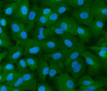 INF2 Antibody A549 Cell IF. Immunofluorescent staining of FFPE human A549 cells with INF2 Antibody (green) and DAPI nuclear counterstain (blue). HIER was performed by steaming tissue sections in pH 6 citrate buffer for 20 minutes prior to staining. INF2 Antibody / Actin Regulation Protein Antibody demonstrates cytoplasmic staining consistent with Inverted Formin 2 expression and supports studies of actin cytoskeleton remodeling, cellular structure regulation and intracellular organization pathways.
