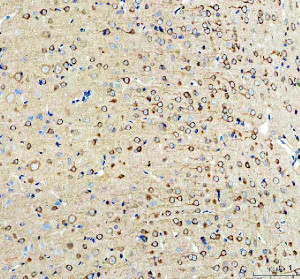 INF2 Antibody Rat Brain IHC. Immunohistochemistry staining of FFPE rat brain tissue with INF2 Antibody at 2 ug/ml. HIER was performed using pH 8 EDTA buffer, followed by blocking with 10% goat serum. The tissue section was incubated with rabbit anti-INF2 antibody overnight at 4Â°C, followed by HRP-conjugated goat anti-rabbit IgG secondary antibody and DAB chromogen detection. INF2 Antibody / Actin Regulation Protein Antibody demonstrates cytoplasmic staining consistent with Inverted Formin 2 expression and supports studies of actin cytoskeleton remodeling, neuronal cell biology and intracellular organization pathways.