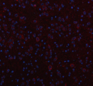 INF2 Antibody Rat Brain IF. Immunofluorescent staining of FFPE rat brain tissue with INF2 Antibody at 5 ug/ml. HIER was performed using pH 8 EDTA buffer, followed by blocking with 10% goat serum. The tissue section was incubated with rabbit anti-INF2 antibody overnight at 4Â°C, followed by Cy3 conjugated goat anti-rabbit IgG secondary antibody (red). Nuclei were counterstained with DAPI (blue). INF2 Antibody / Actin Regulation Protein Antibody demonstrates cytoplasmic staining consistent with Inverted Formin 2 expression and supports studies of actin cytoskeleton remodeling, neuronal cell structure and intracellular organization pathways.