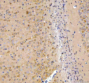 INF2 Antibody Mouse Brain IHC. Immunohistochemistry staining of FFPE mouse brain tissue with INF2 Antibody at 2 ug/ml. HIER was performed using pH 8 EDTA buffer, followed by blocking with 10% goat serum. The tissue section was incubated with rabbit anti-INF2 antibody overnight at 4Â°C, followed by HRP-conjugated goat anti-rabbit IgG secondary antibody and DAB chromogen detection. INF2 Antibody / Actin Regulation Protein Antibody demonstrates cytoplasmic staining consistent with Inverted Formin 2 expression and supports studies of actin cytoskeleton remodeling, neuronal cell structure and intracellular organization pathways.