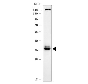 CLEC7A Antibody RT4 WB. Western blot analysis of human RT4 cell lysate using CLEC7A antibody detects a prominent band at approximately 35-40 kDa, consistent with the expected molecular weight range of glycosylated CLEC7A / Dectin-1, an innate immune beta-glucan receptor involved in fungal recognition and myeloid immune signaling. Variable migration within the approximately 27-45 kDa range may occur depending on glycosylation state and receptor processing.