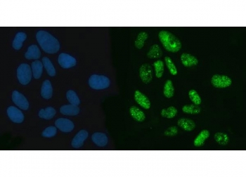 Immunofluorescent staining of FFPE human U-2 OS cells with XPO5 antibody (green) and DAPI nuclear stain (blue). HIER: steam section in pH6 citrate buffer for 20 min.