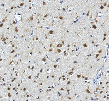 IHC staining of FFPE human brain tissue with SEC13L1 antibody, HRP-secondary and DAB substrate. HIER: boil tissue sections in pH8 EDTA for 20 min and allow to cool before testing.