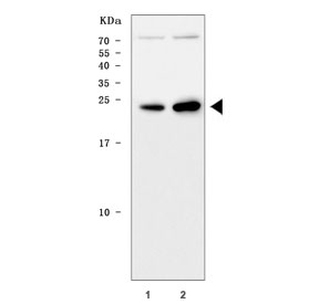 Western blot testing of 1) rat brain and 2) mouse brain tissue lysate with TPPP antibody. Predicted molecular weight ~24 kDa.