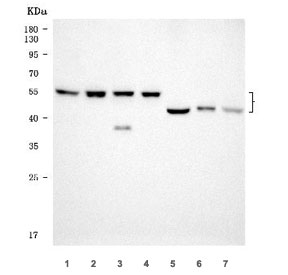 SERBP1 Antibody Human Mouse Rat WB. Western blot testing of 1) human LNCaP, 2) human K562, 3) human Daudi, 4) human HEL, 5) rat kidney, 6) mouse skeletal muscle and 7) mouse kidney tissue lysate with SERBP1 antibody. Predicted molecular weight ~45 kDa but observed at 45-60 kDa.