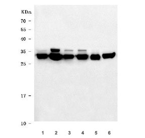 VAPA Antibody Multi-Species WB. Western blot analysis of 1) human HeLa, 2) human K562, 3) human 293T, 4) human HepG2, 5) rat brain, and 6) mouse brain lysates using VAPA Antibody / ER Membrane Contact Site Protein demonstrates a prominent band at approximately 28-33 kDa, consistent with the expected molecular weight of Vesicle-Associated Membrane Protein-Associated Protein A (VAPA). Multiple closely migrating bands are observed in some samples, consistent with reported VAPA isoforms and post-translationally modified forms. VAPA is an endoplasmic reticulum-associated membrane protein that regulates membrane contact site formation, intracellular trafficking, lipid transport, and organelle communication. The observed cross-species reactivity supports application of this antibody for detection of VAPA expression in human, rat, and mouse tissues and cell lines.