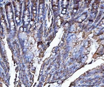 VAPA Antibody Rat Colon IHC. Immunohistochemistry staining of FFPE rat colon tissue using VAPA Antibody / ER Membrane Contact Site Protein demonstrates moderate HRP-DAB brown staining within colonic epithelial cells and associated glandular structures. The observed staining pattern is predominantly membranous and cytoplasmic, consistent with expression of Vesicle-Associated Membrane Protein-Associated Protein A (VAPA), an endoplasmic reticulum-associated protein involved in membrane contact site formation, intracellular trafficking, lipid transport, and organelle communication. Staining highlights epithelial cell populations throughout the colonic mucosa and supports evaluation of VAPA expression and localization in rat gastrointestinal tissue. Heat-induced epitope retrieval was performed by boiling tissue sections in pH 8 EDTA buffer for 20 minutes followed by cooling prior to staining.
