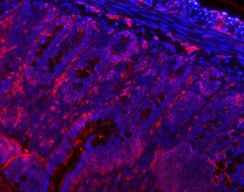 VAPA Antibody Rat Colon IF. Immunofluorescence staining of FFPE rat colon tissue using VAPA Antibody / ER Membrane Contact Site Protein demonstrates distinct red fluorescence within colonic epithelial cell populations lining the mucosal glandular structures. The observed staining pattern is predominantly cytoplasmic with associated membranous localization, consistent with expression of Vesicle-Associated Membrane Protein-Associated Protein A (VAPA), an endoplasmic reticulum-associated protein involved in membrane contact site formation, intracellular trafficking, lipid transport, and organelle communication. Signal highlights epithelial architecture throughout the colonic mucosa, while nuclei are counterstained with DAPI (blue). Heat-induced epitope retrieval was performed by steaming tissue sections in pH 8 EDTA buffer for 20 minutes prior to staining. Target protein is visualized in red and nuclei are shown in blue.