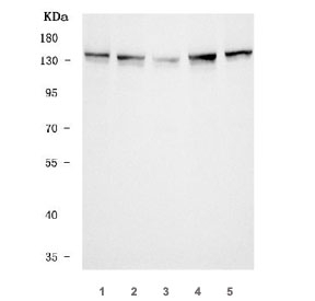 Western blot testing of human 1) Jurkat, 2) HeLa, 3) HepG2, 4) HEL and 5) K562 cell lysate with Tripeptidyl-peptidase 2 antibody. Predicted molecular weight ~138 kDa.