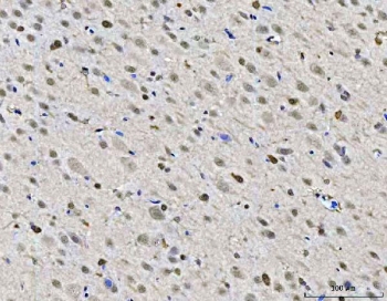 IHC staining of FFPE rat brain tissue with ZMYND8 antibody. HIER: boil tissue sections in pH8 EDTA for 20 min and allow to cool before testing.
