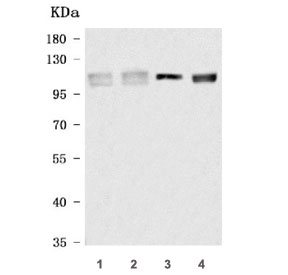 Western blot testing of 1) human RT4, 2) human MOLT-4, 3) rat brain and 4) mouse brain tissue lysate with INPP4A antibody. Predicted molecular weight: 106-110 kDa (multiple isoforms).