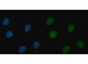 Immunofluorescent staining of FFPE human A549 cells with THAP11 antibody (green) and DAPI nuclear stain (blue). HIER: steam section in pH6 citrate buffer for 20 min.