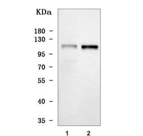 Western blot testing of human 1) SH-SY5Y and 2) MCF7 cell lysate with Thrombospondin-3 antibody. Predicted molecular weight ~104 kDa but may be observed at higher molecular weights due to glycosylation.