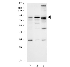Western blot testing of human 1) 293T, 2) HepG2 and 3) U-251 cell lysate with hKR3 antibody. Predicted molecular weight ~77 kda.