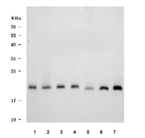 Western blot testing of 1) human HeLa, 2) human PC-3, 3) human 293T, 4) human MCF7, 5) rat brain, 6) rat C6 and 7) mouse brain tissue lysate with TMEM65 antibody. Predicted molecular weight ~25 kDa, commonly observed at 20-25 kDa.