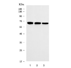 Western blot testing of human 1) HeLa, 2) 293T and 3) Jurkat cell lysate with THUMP domain-containing protein 3 antibody. Predicted molecular weight ~57 kDa.
