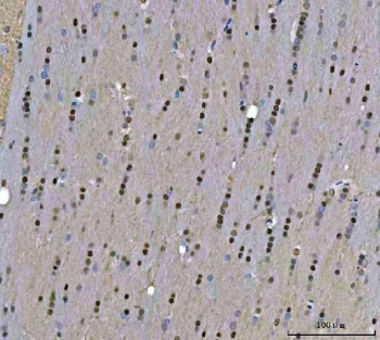 IHC staining of FFPE mouse brain tissue with TIGD1 antibody. HIER: boil tissue sections in pH8 EDTA for 20 min and allow to cool before testing.