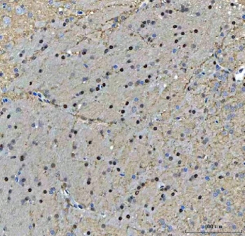 IHC staining of FFPE rat brain tissue with TIGD1 antibody. HIER: boil tissue sections in pH8 EDTA for 20 min and allow to cool before testing.