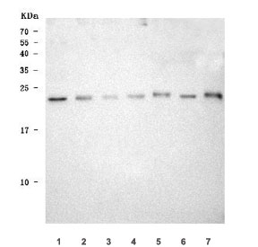 Western blot testing of 1) human 293T, 2) monkey COS-7, 3) human SiHa, 4) rat NRK, 5) mouse kidney and 6) mouse HBZY-1 cell lysate with TMEM52B antibody. Predicted molecular weight ~20 kDa.