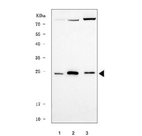 Western blot testing of human 1) MCF7, 2) 293T and 3) HepG2 cell lysate with TRIR antibody. The predicted molecular weight of TRIR is ~18 kDa, commonly observed at 18-28 kDa.